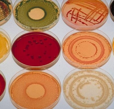 Супербактерии. Почему антибиотики потеряли силу